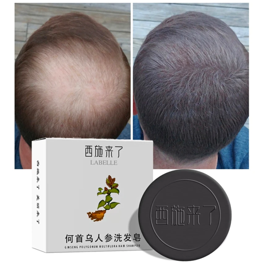 Essential Oil Shampoo Soap Natural Chinese Medicine Extract Hair Growth Essence Hair Loss Treatment Liquid Hair Growth Products
Essential Oil Shampoo Soap Natural Chinese Medicine Extract Hair Growth Essence Hair Loss Treatment Liquid Hair Growth Products