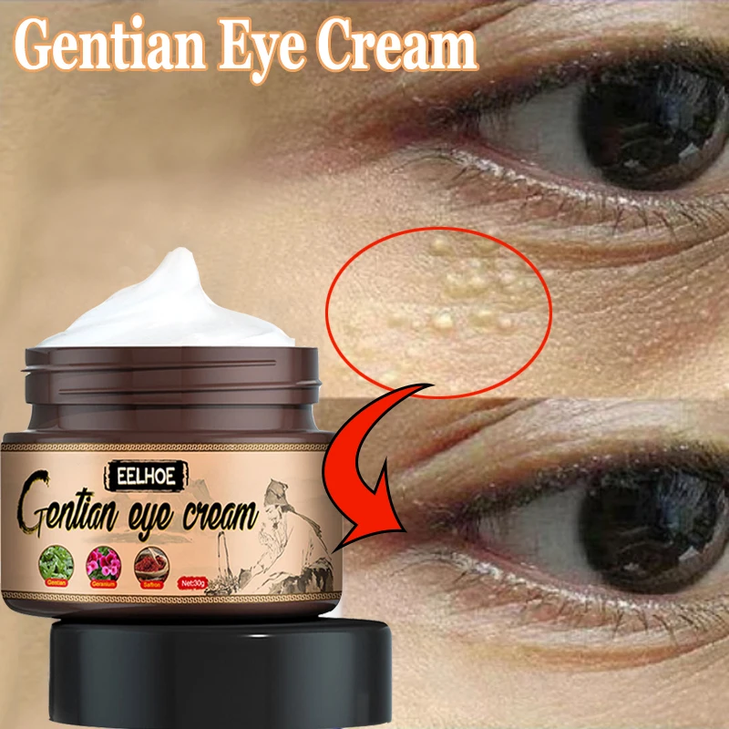 30g Natural Removes Fat Granules Eyes Cream Remove Dark Circle Eye Bags Improve Fine Wrinkle Moisturizing Skin Eye Care Cream
30g Natural Removes Fat Granules Eyes Cream Remove Dark Circle Eye Bags Improve Fine Wrinkle Moisturizing Skin Eye Care Cream