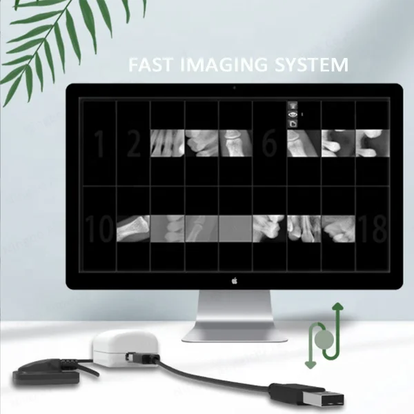 X1009 Portable digital RVG x-ray sensor x ray xray Intraoral sensor for Adult and children
X1009 Portable digital RVG x-ray sensor x ray xray Intraoral sensor for Adult and children