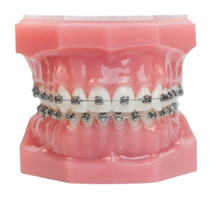 Dental Materials Orthodontic Super Elastic Nitinol Round Orthodontic Archwires Braces Dental/Niti Rrchwire
Dental Materials Orthodontic Super Elastic Nitinol Round Orthodontic Archwires Braces Dental/Niti Rrchwire