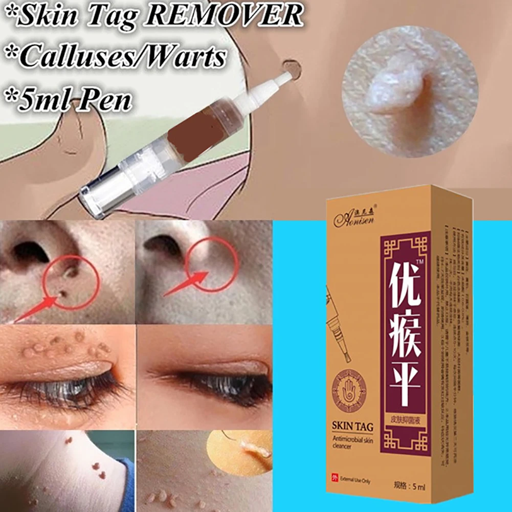 25g Wart Removal Ointment Wart Treatment Liquid Neck Skin Tag Armpit Flat Warts Genital Warts Foot Corns Medical Wart Cream
25g Wart Removal Ointment Wart Treatment Liquid Neck Skin Tag Armpit Flat Warts Genital Warts Foot Corns Medical Wart Cream
