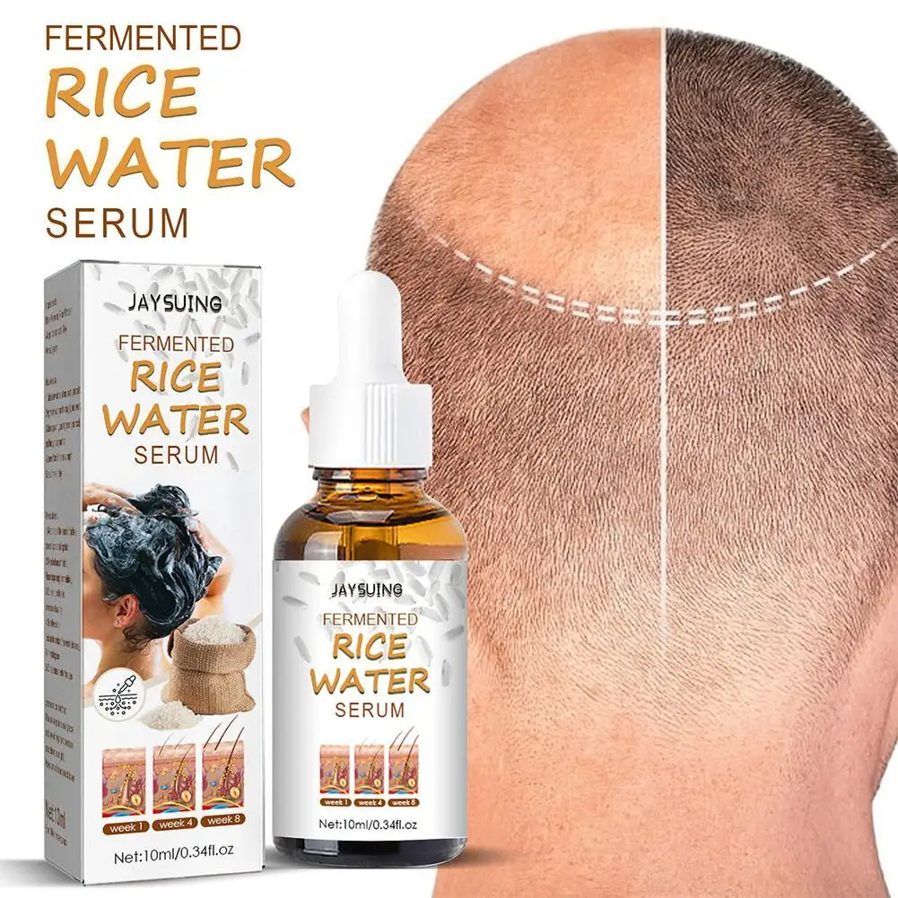 

Sdotter Fermented Rice Water Serum Hair Growth for Thinning Hair and Hair Loss Hair Essence Moisturizes Repair Hair Dryness Oil