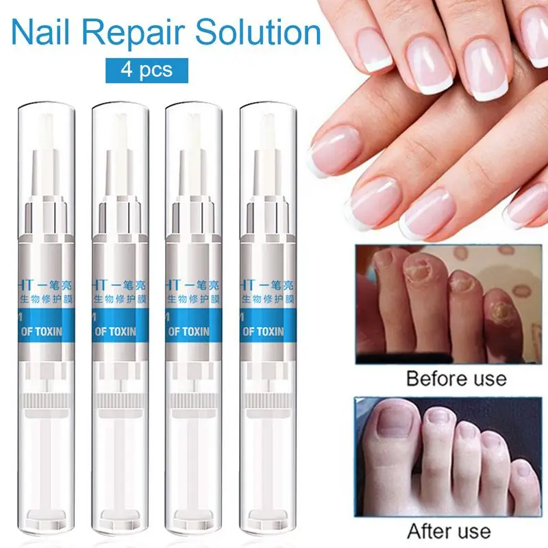 Nail Repair Pen Products Onychomycosis Paronychia Anti Nail Chinese Herbal Care Oil Pen
Nail Repair Pen Products Onychomycosis Paronychia Anti Nail Chinese Herbal Care Oil Pen