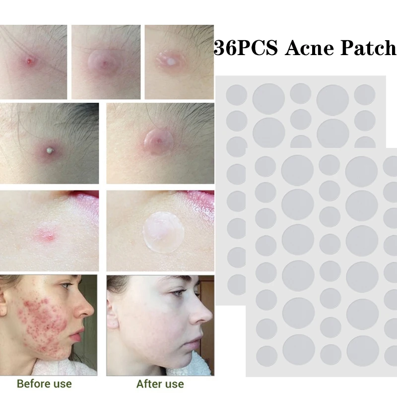 36pcs/set Invisible Pimple Acne Remover Patch Fast Effect Adhesive Hydrocolloid Patches Acne Beauty Tools for Face Skin Care
36pcs/set Invisible Pimple Acne Remover Patch Fast Effect Adhesive Hydrocolloid Patches Acne Beauty Tools for Face Skin Care