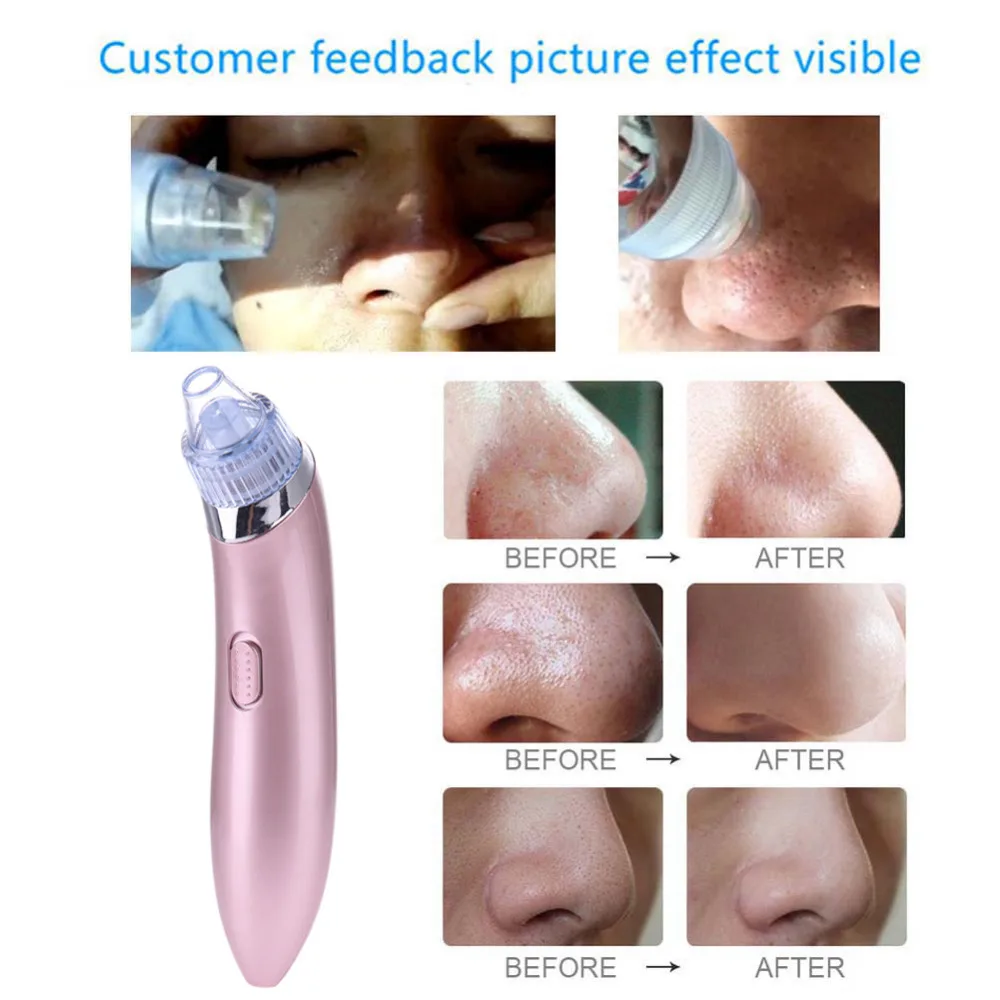 

Pro Vacuum Pore Cleaner Blackhead Remover Electric Acne Clean Exfoliating Cleansing Comedo Suction Facial Beauty Machine