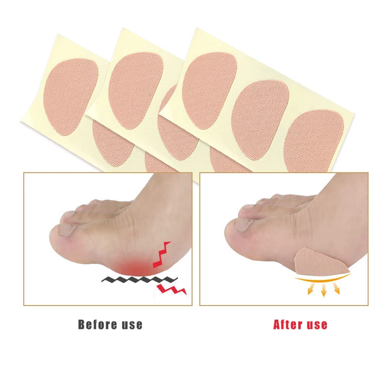 Foot Corn Removal Calluses Plantar Warts Thorn Pain Relief Plaster Foot Care for Relieving Pain Anti Rubbing Heel Pad Stickers
Foot Corn Removal Calluses Plantar Warts Thorn Pain Relief Plaster Foot Care for Relieving Pain Anti Rubbing Heel Pad Stickers