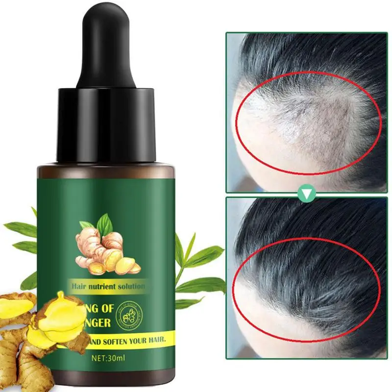 Эфирные масла для роста волос, 30 мл, нежирная эссенция для волос, питательная эссенция для ухода за волосами, товары для прямых и вьющихся волос
Эфирные масла для роста волос, 30 мл, нежирная эссенция для волос, питательная эссенция для ухода за волосами, товары для прямых и вьющихся волос