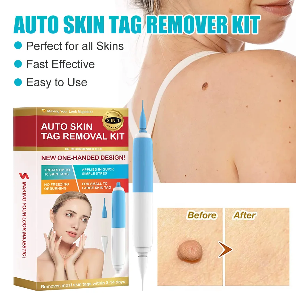 2 In 1 Auto Skin Tag Remover Kit Painless Quick Removal For Wart Mole Skin Tag Removal Device Adults Skin Beauty Tool
2 In 1 Auto Skin Tag Remover Kit Painless Quick Removal For Wart Mole Skin Tag Removal Device Adults Skin Beauty Tool