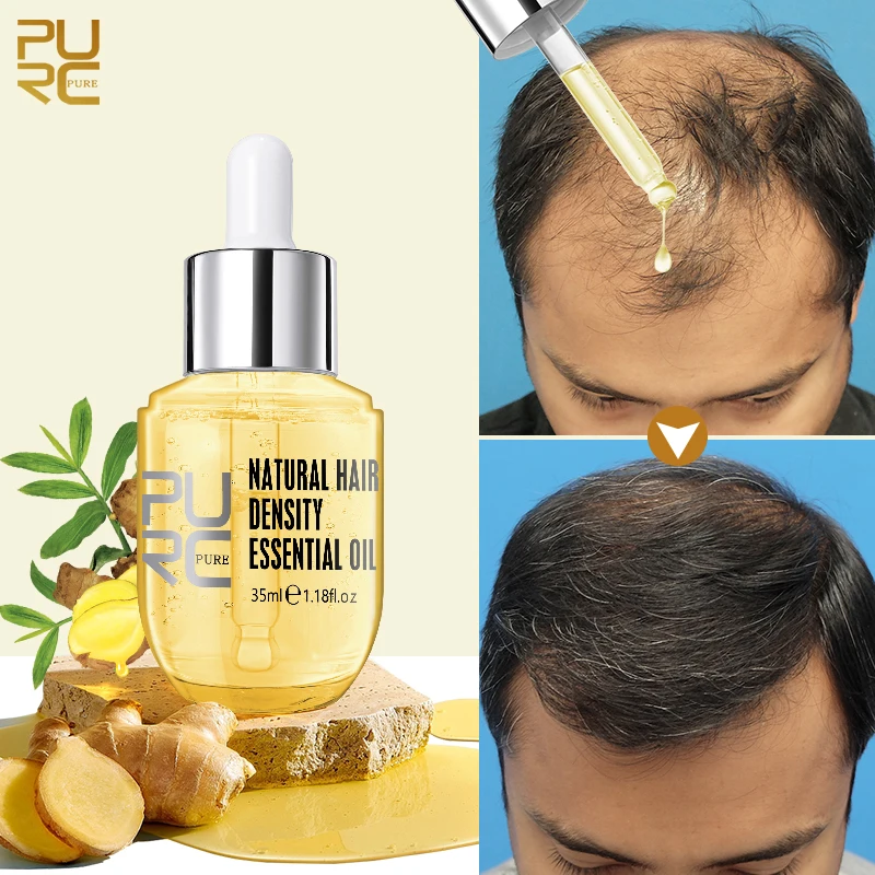PURC Ginger Hair Growth Essential Oil Anti Hair Loss Products Fast Growing Hair Scalp Treatment Beauty Health for Men Women
PURC Ginger Hair Growth Essential Oil Anti Hair Loss Products Fast Growing Hair Scalp Treatment Beauty Health for Men Women