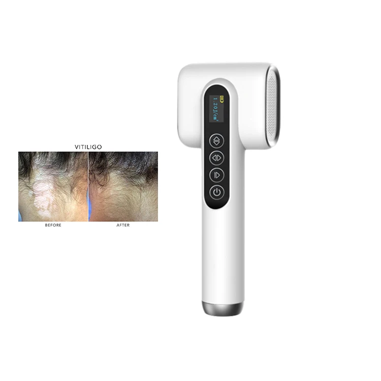 Diosole brand phototherapy manufacture 308nm uv light therapy treatment for vitiligo psoriasis
Diosole brand phototherapy manufacture 308nm uv light therapy treatment for vitiligo psoriasis