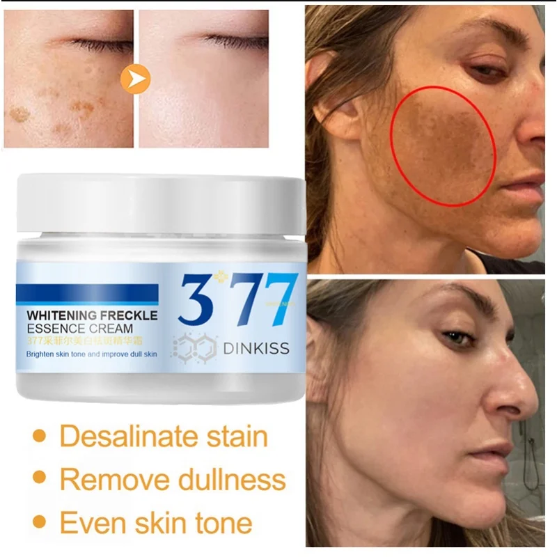 DinKiss 377 Whitening Freckle Removing Essence Cream Professional Whitening Inhibits Melanin Growth Brightens Skin Color
DinKiss 377 Whitening Freckle Removing Essence Cream Professional Whitening Inhibits Melanin Growth Brightens Skin Color