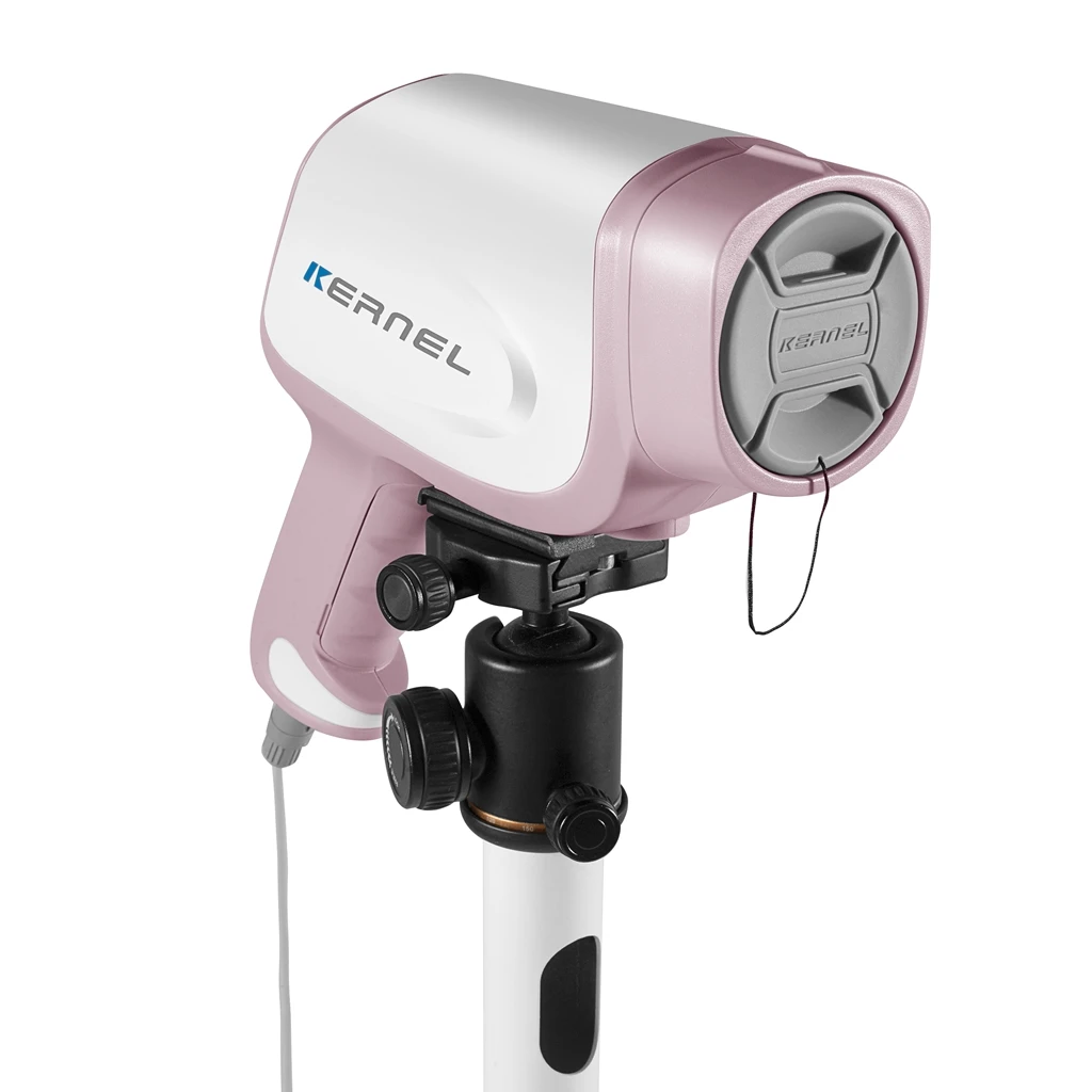 HD video colposcope camera digital camera sony colposcopy for gynecology examination in Clinic 3,270,000 pixels hospital use
HD video colposcope camera digital camera sony colposcopy for gynecology examination in Clinic 3,270,000 pixels hospital use