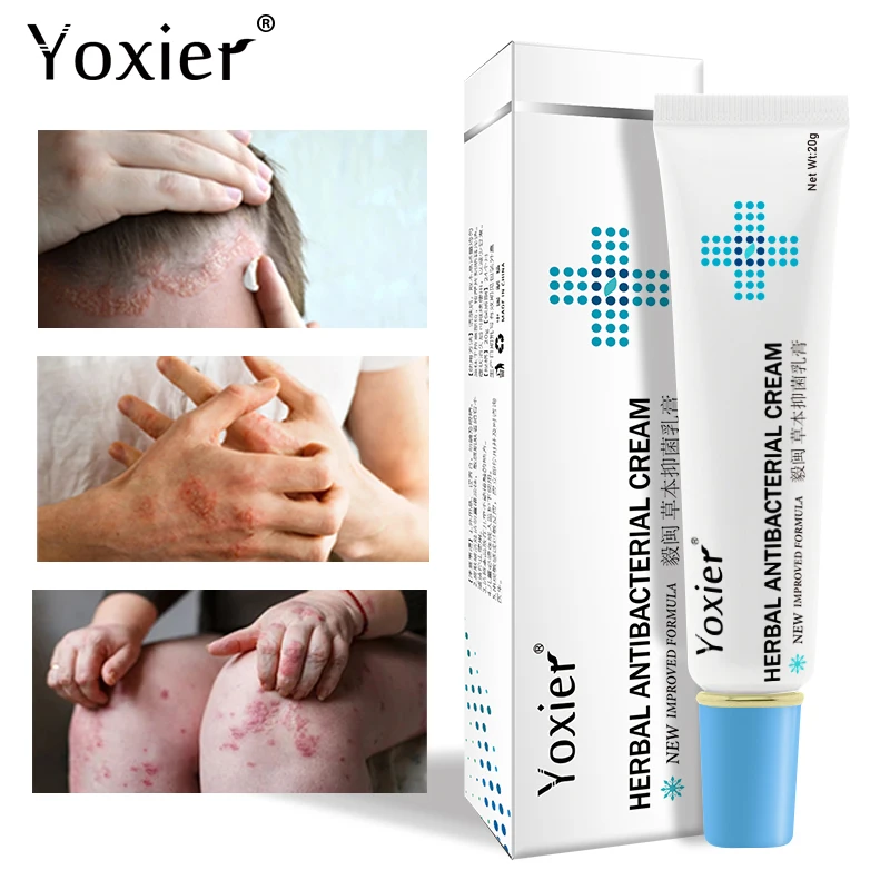 Yoxier Herbal Antibacterial Cream Effective Treatment Psoriasis Dermatitis Eczema Natural Antipruritic Pigmentation Skin Care
Yoxier Herbal Antibacterial Cream Effective Treatment Psoriasis Dermatitis Eczema Natural Antipruritic Pigmentation Skin Care