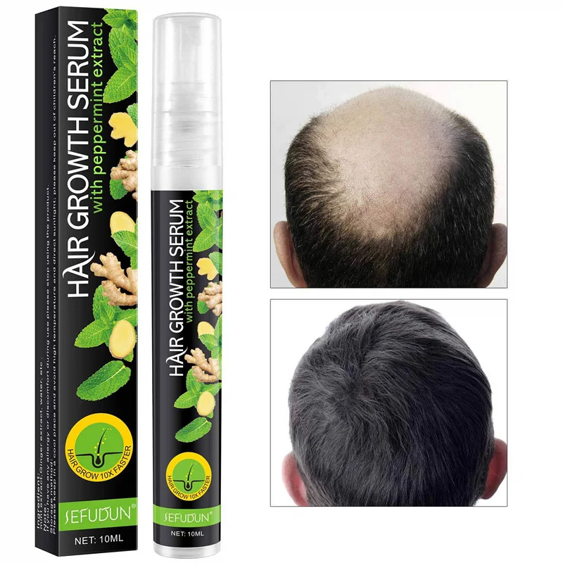 Male and Female Ginger Hair Growth Spray Natural Anti Hair Loss Products Rapid Growth Essence To Prevent Hair
Male and Female Ginger Hair Growth Spray Natural Anti Hair Loss Products Rapid Growth Essence To Prevent Hair