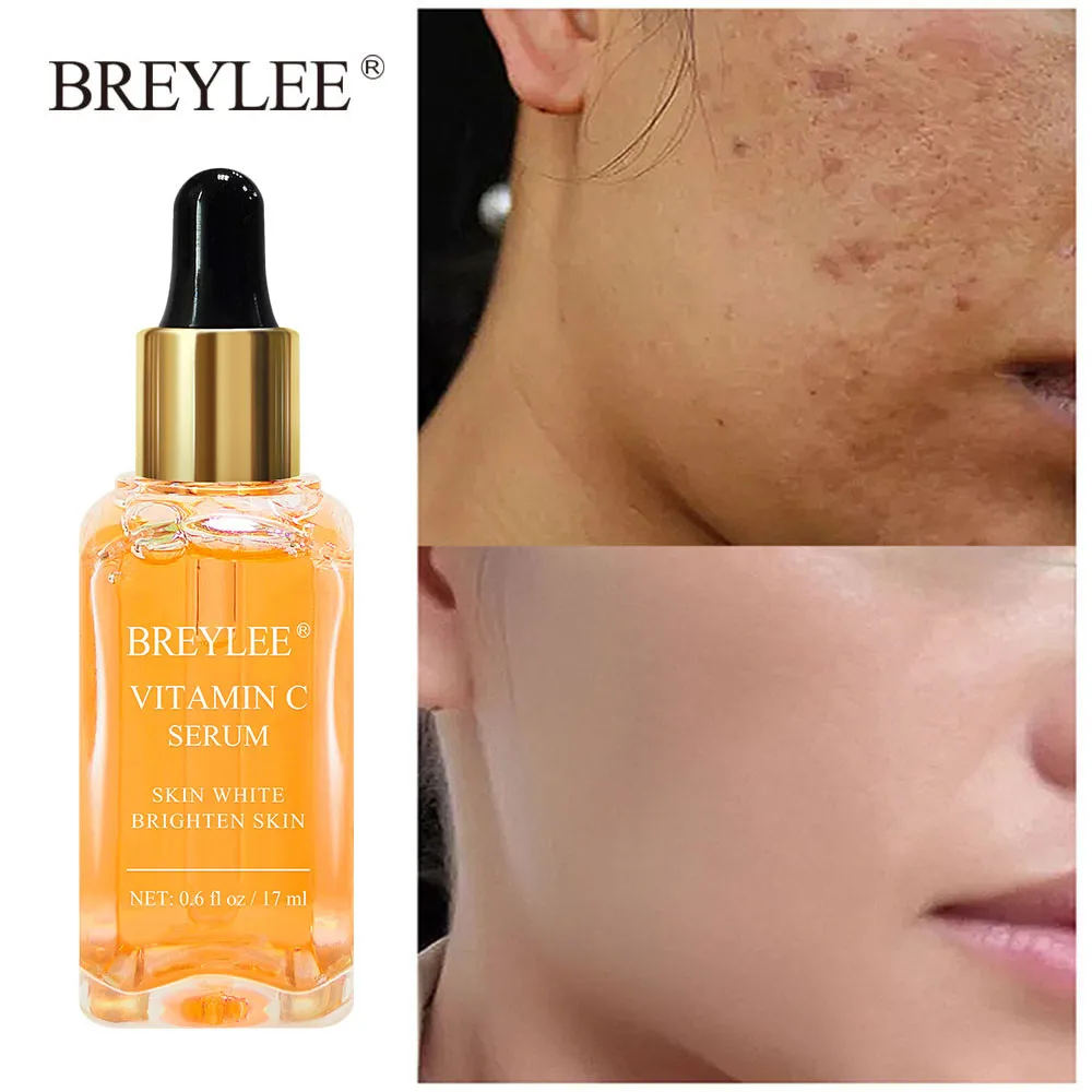 Effective Whitening Cream Freckle Cream Remove Melasma Dark Spot Lightening Melanin Anti-aging Moisturize Brightening Face Care
Effective Whitening Cream Freckle Cream Remove Melasma Dark Spot Lightening Melanin Anti-aging Moisturize Brightening Face Care
