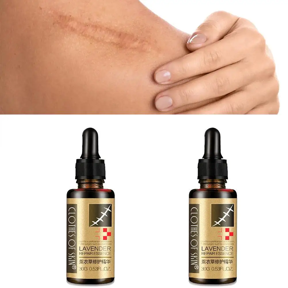 1pcs Lavender Repair Essence Scar Removal Essential Pregnant Massage Oil Hyaluronic Acid Serum Oil Essential Face Wholesale
1pcs Lavender Repair Essence Scar Removal Essential Pregnant Massage Oil Hyaluronic Acid Serum Oil Essential Face Wholesale
