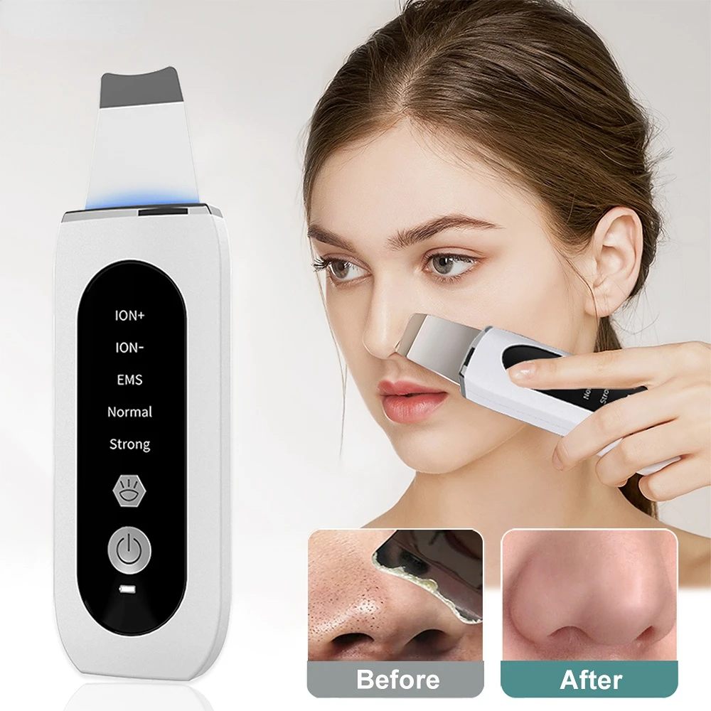

Ultrasonic Skin Scrubber Peeling Blackhead Remover Deep Face Cleaning Ultrasonic Ion Ance Pore Cleaner Facial Shovel Cleanser