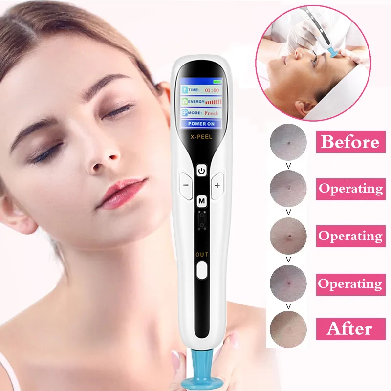3 In 1 Plamax Ozone Fibroblast Plasma Pen Wart Freckle Mole Remover Eyelid Lifting Acne Removal Skin Care Beauty Machine
3 In 1 Plamax Ozone Fibroblast Plasma Pen Wart Freckle Mole Remover Eyelid Lifting Acne Removal Skin Care Beauty Machine