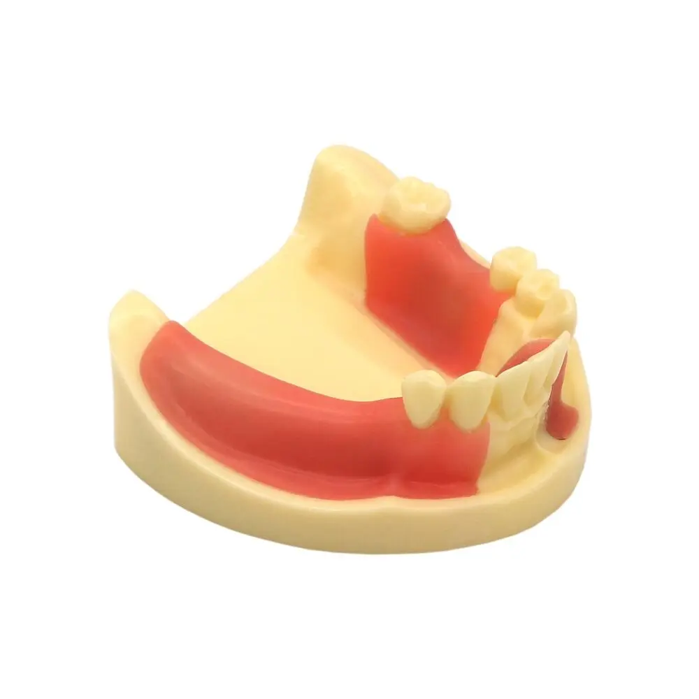 

Dental Lower Jaw Removable Gingiva Implant Teeth Model Practice Demo Typodont Teeth Model M2004