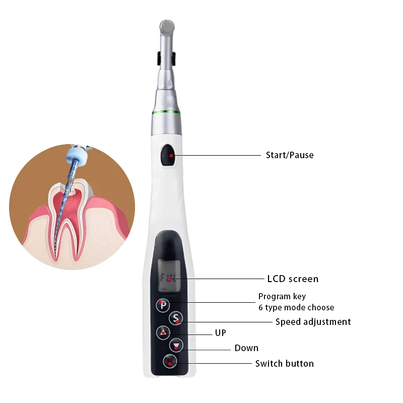 Dental LED Wireless Mini 16:1 Reduction Contra Angle Endo Motor Endodontic Treatment 6 Kinds of Procedures Handpiece
Dental LED Wireless Mini 16:1 Reduction Contra Angle Endo Motor Endodontic Treatment 6 Kinds of Procedures Handpiece