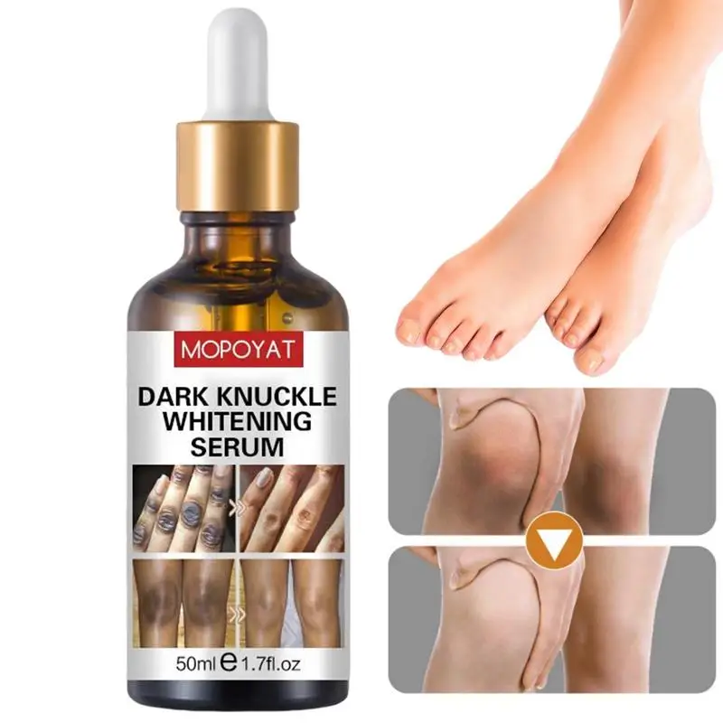 Dark Knuckle Serums 50ml Dark Elbows And Knees Lightening Serums Elbow Whiten Essence Dark Spots Remover For Removing Dark
Dark Knuckle Serums 50ml Dark Elbows And Knees Lightening Serums Elbow Whiten Essence Dark Spots Remover For Removing Dark
