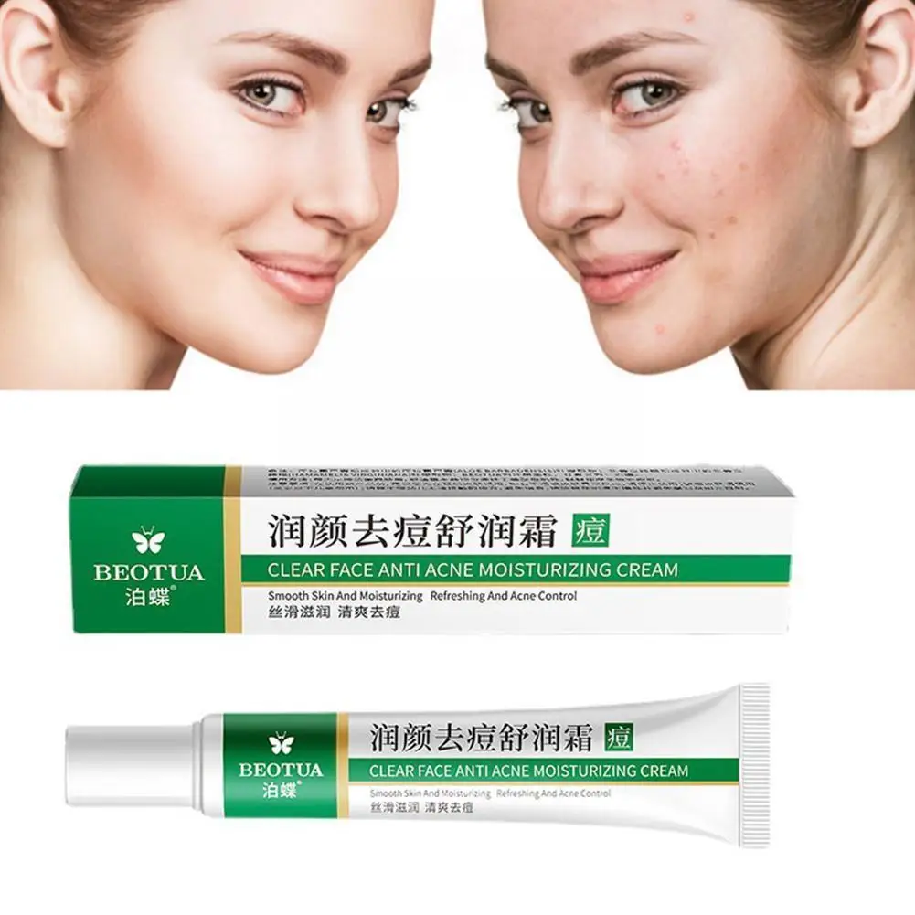Effective Acne Removal Cream Herbal Acne Spots Oil Acne Whitening Care Skin Moisturizing Cream 20g Control Skin Face Gel Ca X4a1
Effective Acne Removal Cream Herbal Acne Spots Oil Acne Whitening Care Skin Moisturizing Cream 20g Control Skin Face Gel Ca X4a1