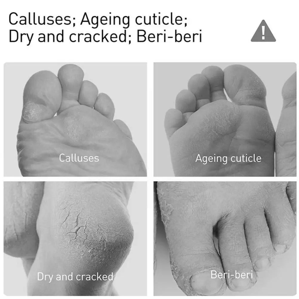 Foot Peeling Spray Natural Essence Improve Dull And Exfoliator Skin Foot Dead Hands Tools Rough Skin Cosmetics Care Whiten R7o7
Foot Peeling Spray Natural Essence Improve Dull And Exfoliator Skin Foot Dead Hands Tools Rough Skin Cosmetics Care Whiten R7o7