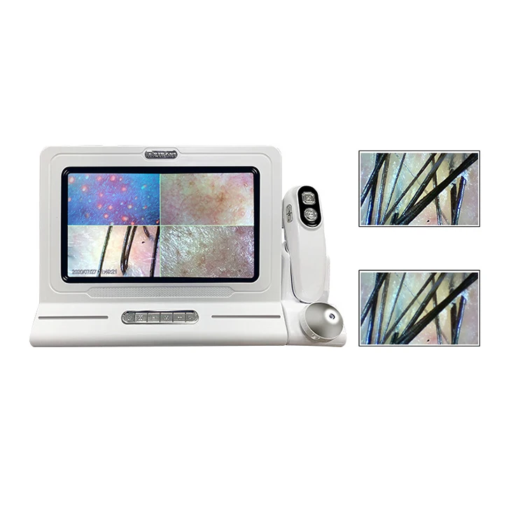Multifunction Portable mini Octa-core four-spectrum hair follicle/scalp/skin scalp analyzer machine skin detection Analyzer
Multifunction Portable mini Octa-core four-spectrum hair follicle/scalp/skin scalp analyzer machine skin detection Analyzer