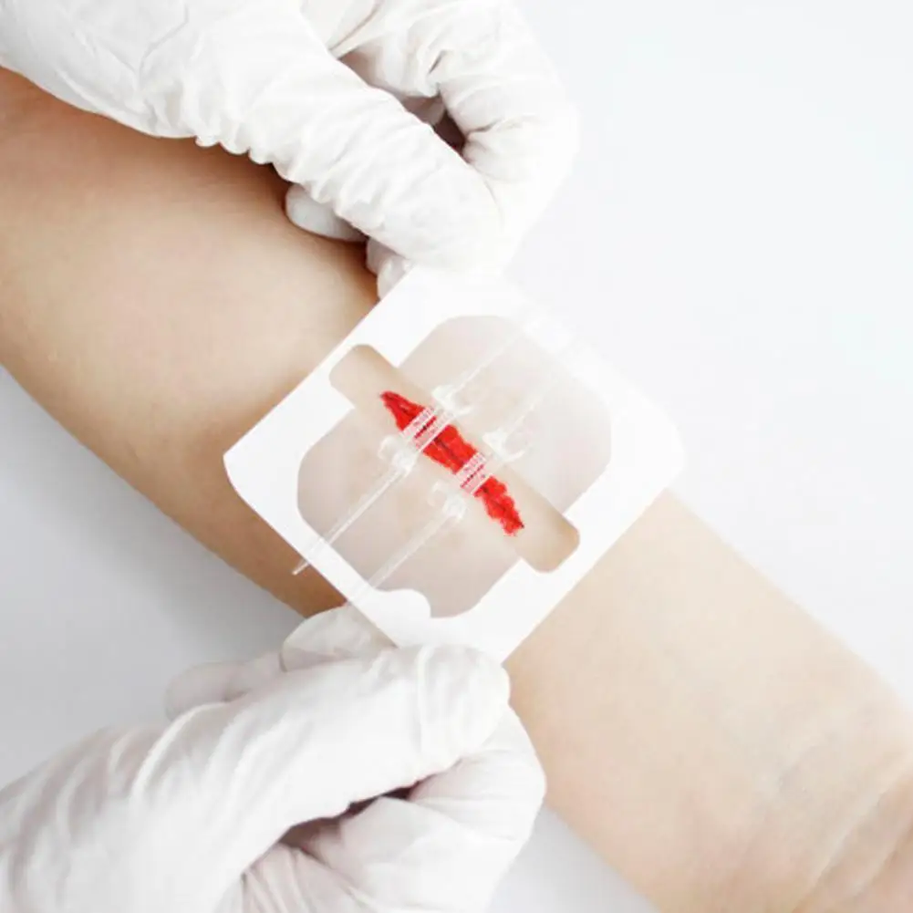 Zipper Band-aid Painless Wound Closure Device Suture-free Wound Band Suture Zip Dressing Patches Aid Reducer P0F0
Zipper Band-aid Painless Wound Closure Device Suture-free Wound Band Suture Zip Dressing Patches Aid Reducer P0F0