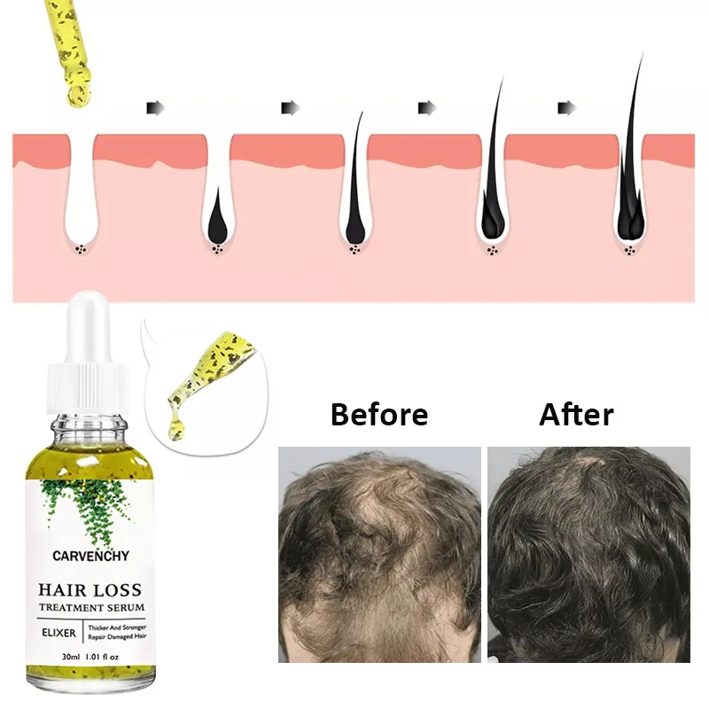 Hair Care Essential Oil Anti-frizz Growth Hairs Smooth Serum Hair Oil Anti Hairs Loss New Treatments Hair Beauty
Hair Care Essential Oil Anti-frizz Growth Hairs Smooth Serum Hair Oil Anti Hairs Loss New Treatments Hair Beauty