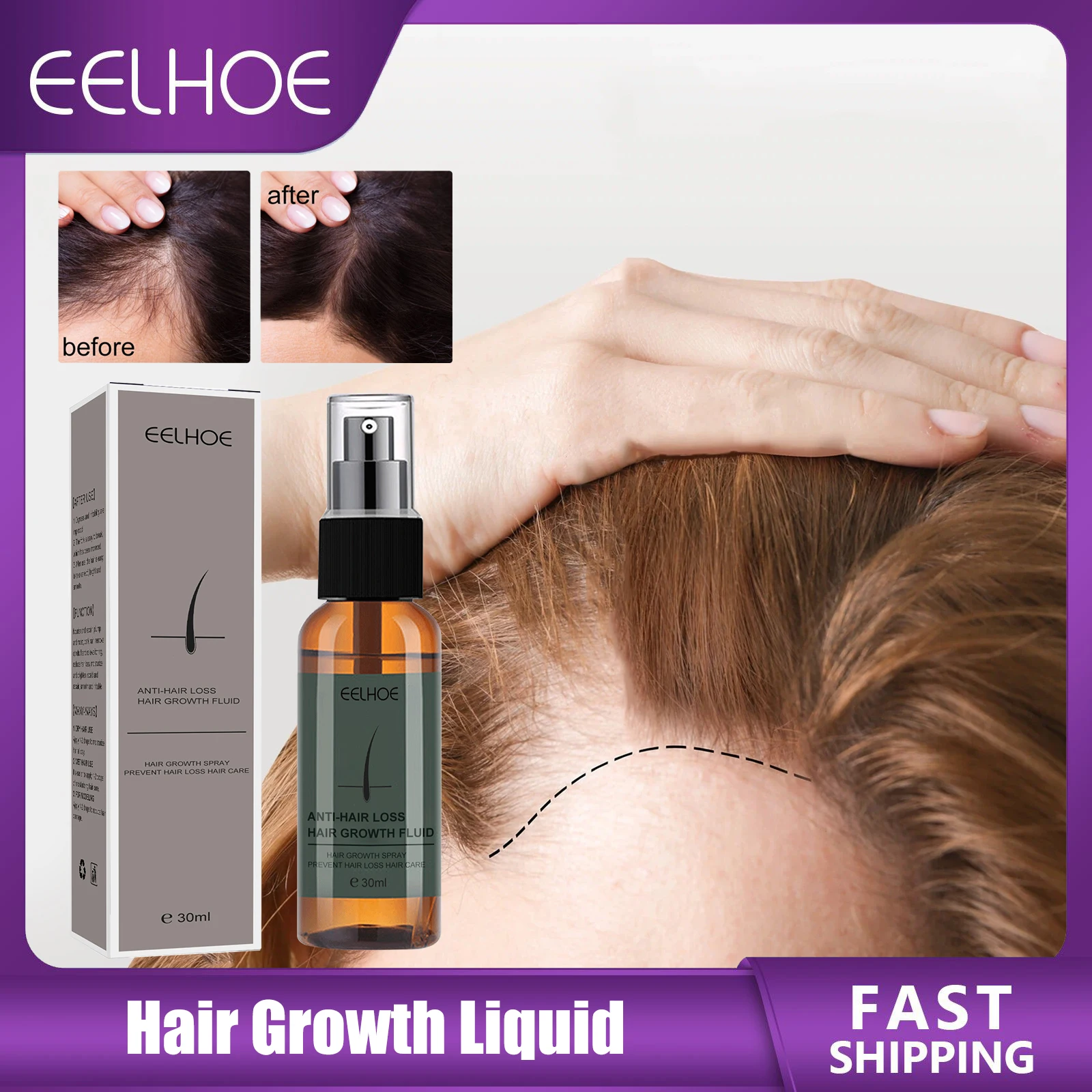 Hair Growth Liquid Prevent Drying Frizzy Nourishing Enhancer Repair Hair Root Ginger Fast Grow Hair Care Treatment Products 30ml
Hair Growth Liquid Prevent Drying Frizzy Nourishing Enhancer Repair Hair Root Ginger Fast Grow Hair Care Treatment Products 30ml
