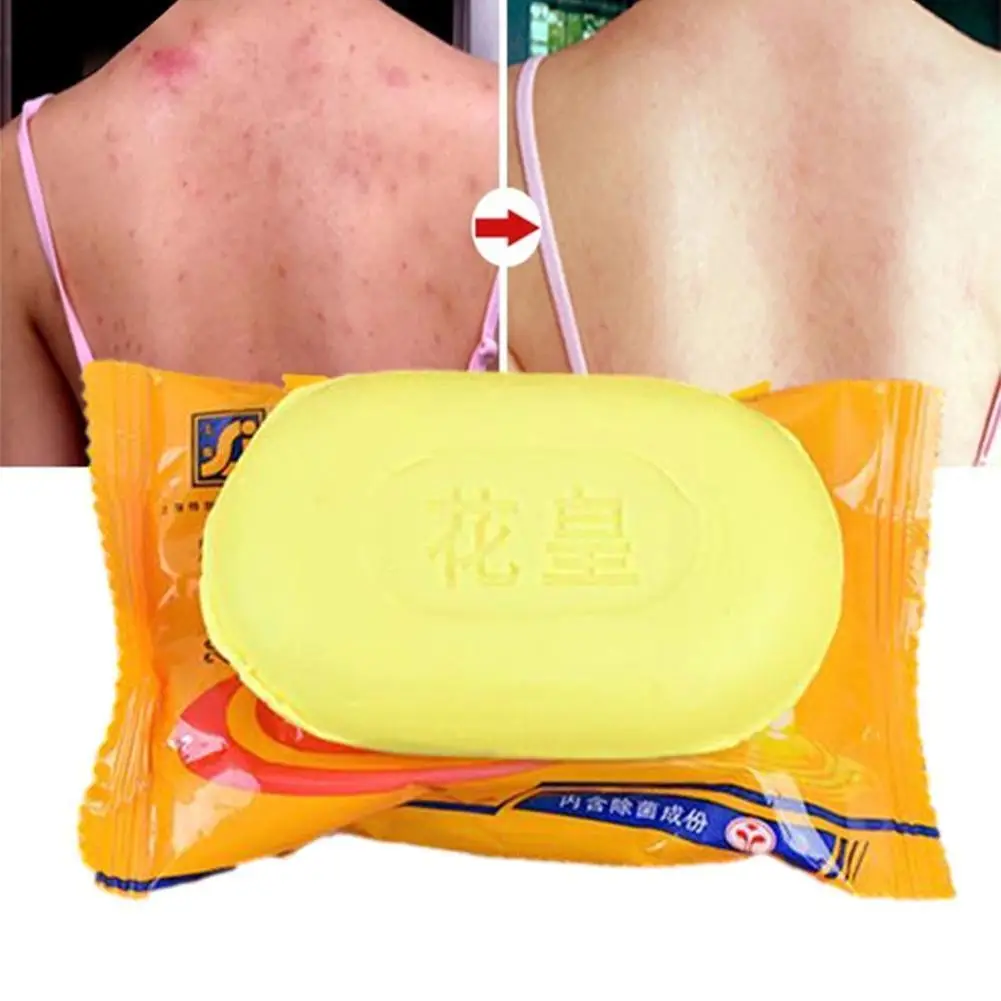 New 85g Sulphur Soap Skin Care Dermatitis Fungus Eczema Bacteria Skin Shower Cleaning Anti Fungus Bath Care Soaps Whitening Q8l6
New 85g Sulphur Soap Skin Care Dermatitis Fungus Eczema Bacteria Skin Shower Cleaning Anti Fungus Bath Care Soaps Whitening Q8l6