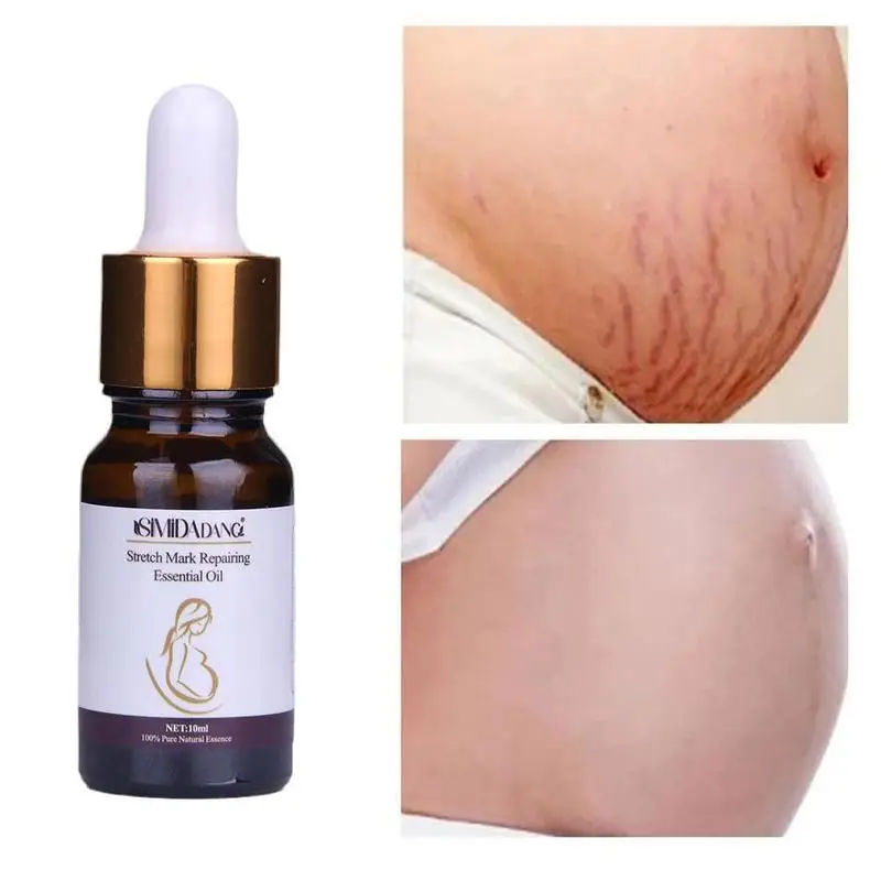 Stretch Marks Treatment Maternity Repair Anti-Winkles Skin Stretch Mark oil Body Firming Repair Essential Care
Stretch Marks Treatment Maternity Repair Anti-Winkles Skin Stretch Mark oil Body Firming Repair Essential Care
