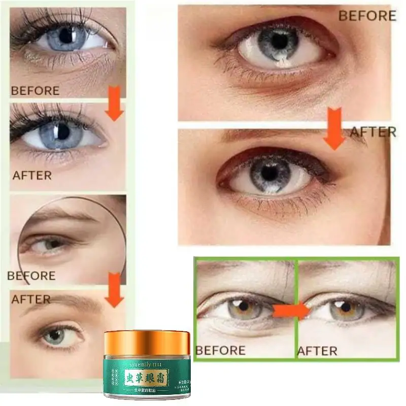 Instant Wrinkle Remover Face Cream Lifting Firming Fade Fine Lines Anti-aging Whitening Moisturizing Brighten Korean Cosmetics
Instant Wrinkle Remover Face Cream Lifting Firming Fade Fine Lines Anti-aging Whitening Moisturizing Brighten Korean Cosmetics