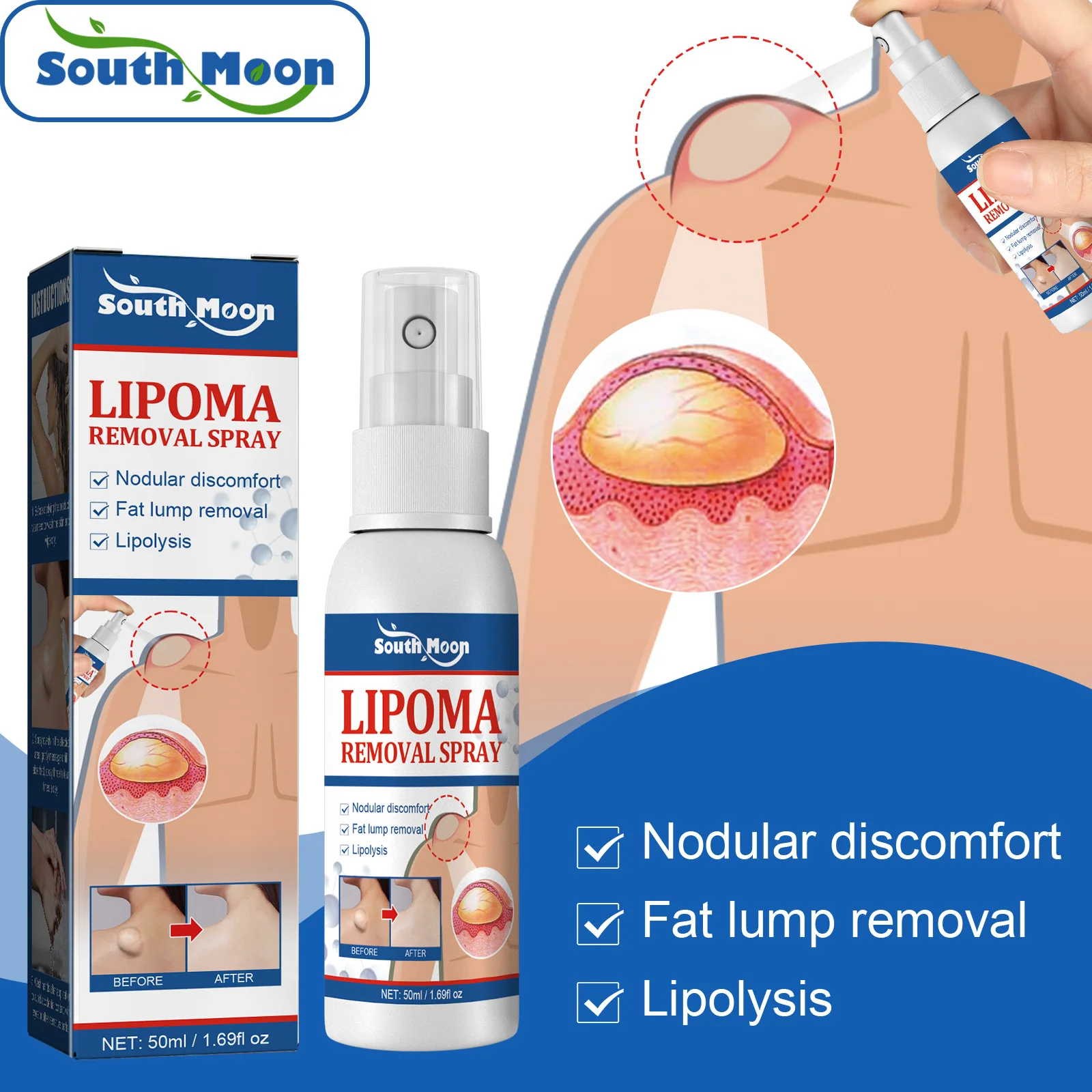 Removing Fat Cream Effectively Resists Tumor Plant Extracts Treatment Fibroma Removers Subcutaneous Masses Blister Fibroma Cream
Removing Fat Cream Effectively Resists Tumor Plant Extracts Treatment Fibroma Removers Subcutaneous Masses Blister Fibroma Cream