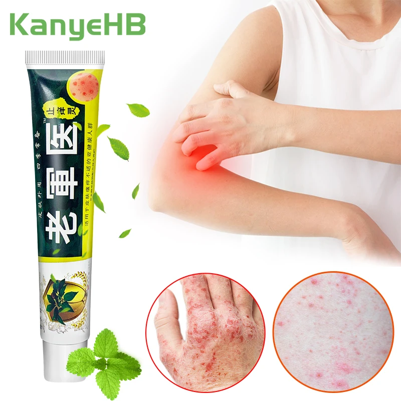 1pc Mint Antipruritic Anti-Bacterial Ointment Chinese Herbal Medicine Dermatitis Eczema Anti-inflammatory Analgesic Cream S114
1pc Mint Antipruritic Anti-Bacterial Ointment Chinese Herbal Medicine Dermatitis Eczema Anti-inflammatory Analgesic Cream S114