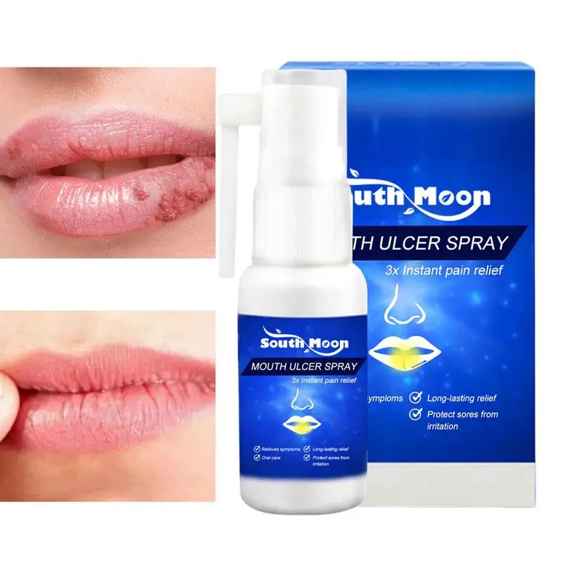 Mouth Aches Relief Spray Oral Spray For Symptomatic Relief Of Aches Gums Toothache Fast-Acting And Long-Lasting For Adults
Mouth Aches Relief Spray Oral Spray For Symptomatic Relief Of Aches Gums Toothache Fast-Acting And Long-Lasting For Adults