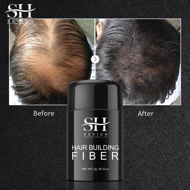 Sevich New Hair Fiber Keratin Instant Hair Growth Spray Hair Building Fiber Applicator Spray Anti Hair Loss Hair Care Products
Sevich New Hair Fiber Keratin Instant Hair Growth Spray Hair Building Fiber Applicator Spray Anti Hair Loss Hair Care Products