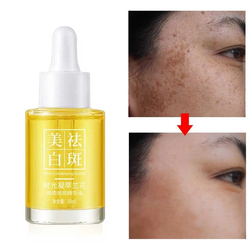 Отбеливание и удаление веснушек экстракт конденсата с временем орхидеи растворяющее масло увлажняющее и увлажняющее
Отбеливание и удаление веснушек экстракт конденсата с временем орхидеи растворяющее масло увлажняющее и увлажняющее