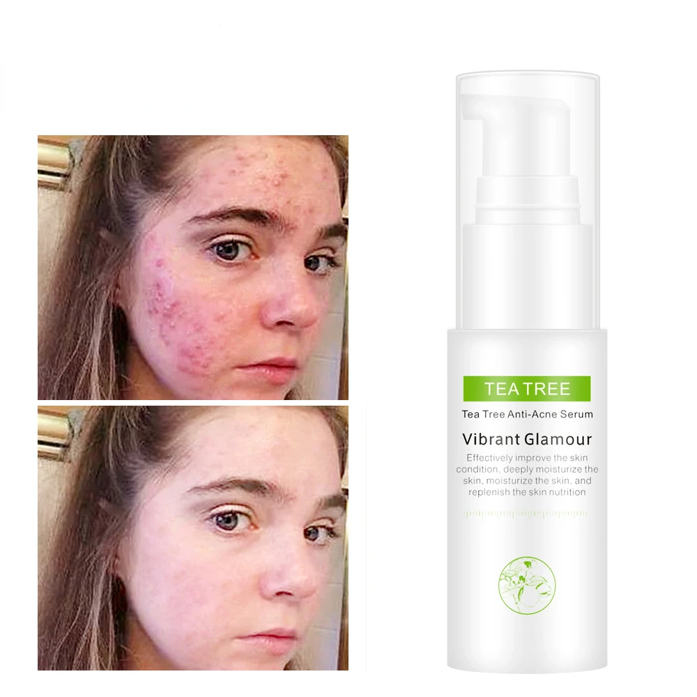 30ml Tea Tree Anti-Acne Serum Water Oil-control Acne Toner Scar Cream Treatment Youth Acne For Face Skin Care Product
30ml Tea Tree Anti-Acne Serum Water Oil-control Acne Toner Scar Cream Treatment Youth Acne For Face Skin Care Product