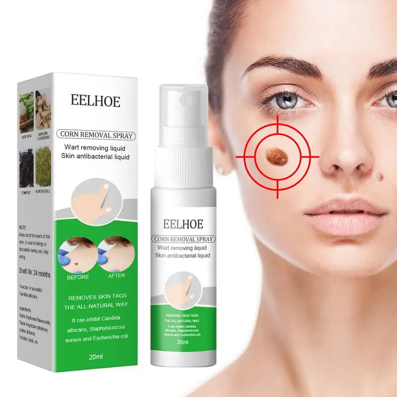Corn Remover Liquid 20ml Wart Remover Skin Tags Remover Against Moles Flat Wart Wart Remover For Feet Anti Verruca Remedy
Corn Remover Liquid 20ml Wart Remover Skin Tags Remover Against Moles Flat Wart Wart Remover For Feet Anti Verruca Remedy