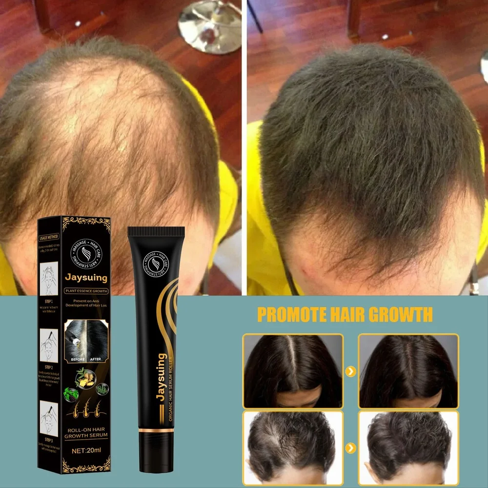 Hair Growth Products Hair Growing Essential Oil Serum Hair Care Prevent Hair Loss Scalp Treatment Dense Hair Growth Serum 20ml
Hair Growth Products Hair Growing Essential Oil Serum Hair Care Prevent Hair Loss Scalp Treatment Dense Hair Growth Serum 20ml