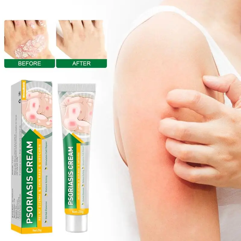 West&Month Psoriasis Itching Relief Cream Antibacterial Pain Repair Scalp Ringworm Treatment Inner Thigh Itchings Topical Unisex
West&Month Psoriasis Itching Relief Cream Antibacterial Pain Repair Scalp Ringworm Treatment Inner Thigh Itchings Topical Unisex