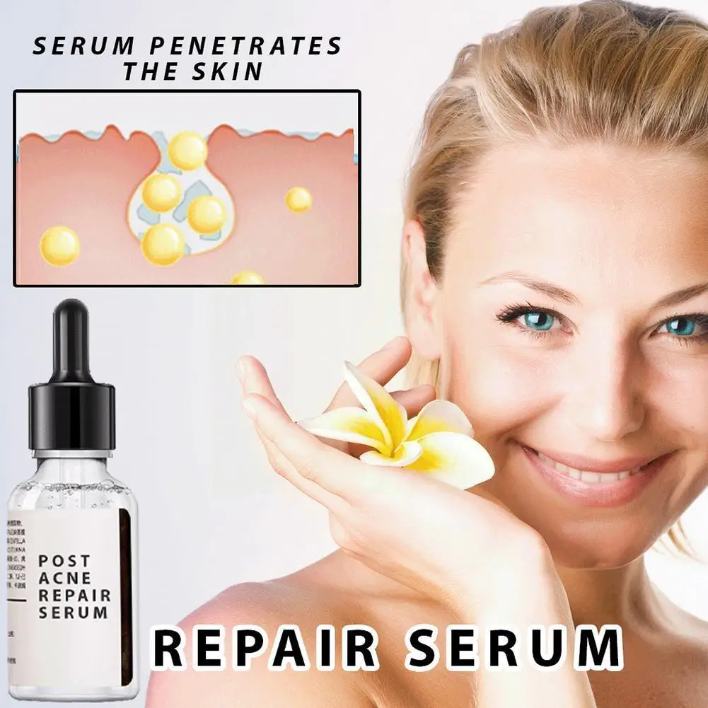 30ml Salicylic Acid 2% Solution Removes Acne Face Serum Moisturizing Essence Spot Pore Fade Brighten Face Skin Care Shrinks Z5p4 
30ml Salicylic Acid 2% Solution Removes Acne Face Serum Moisturizing Essence Spot Pore Fade Brighten Face Skin Care Shrinks Z5p4