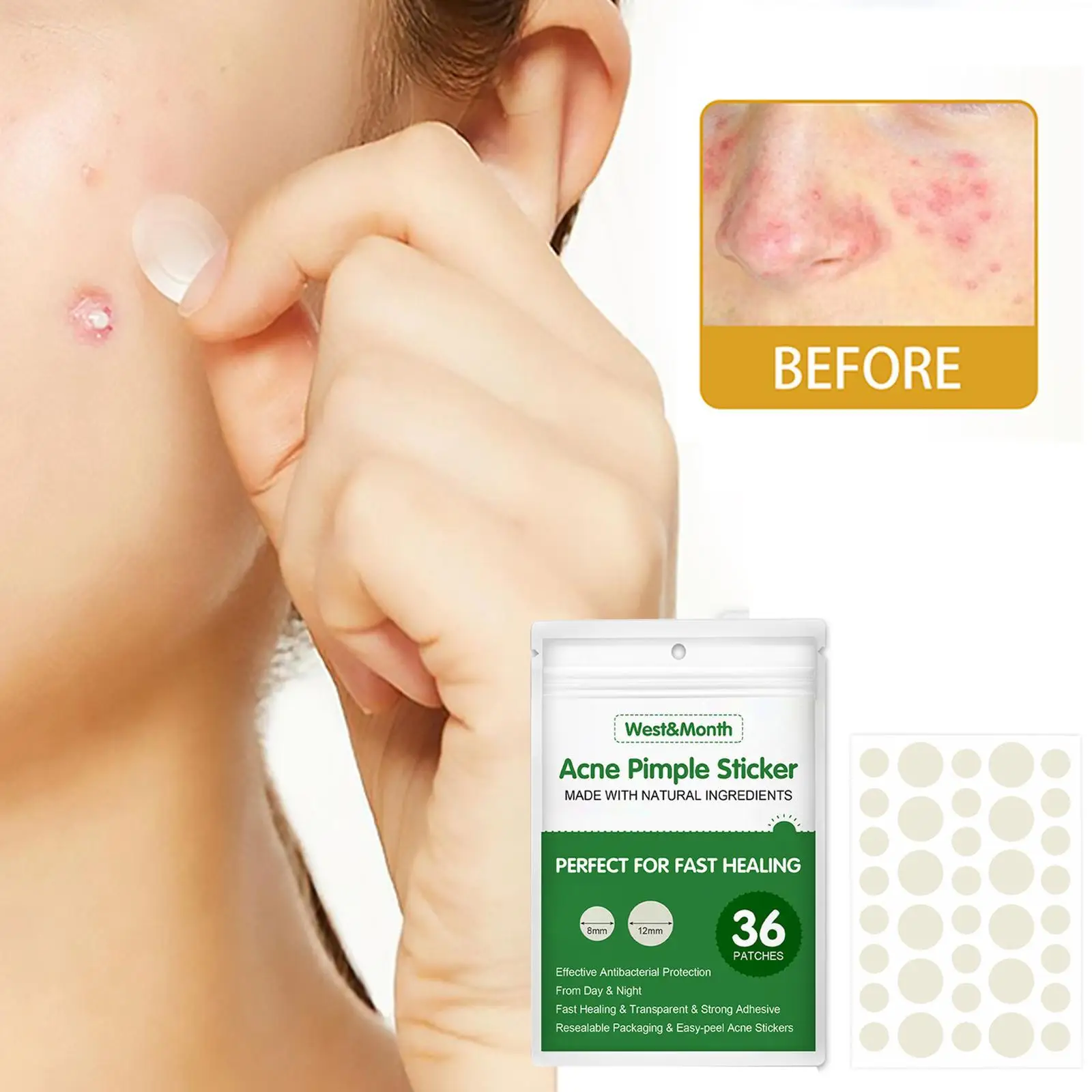 36 Patches Waterproof Acne Pimple Patch Stickers Acne Treatment Pimple Remover Tool Invisible Breathable Acne Patch Skin Care
36 Patches Waterproof Acne Pimple Patch Stickers Acne Treatment Pimple Remover Tool Invisible Breathable Acne Patch Skin Care
