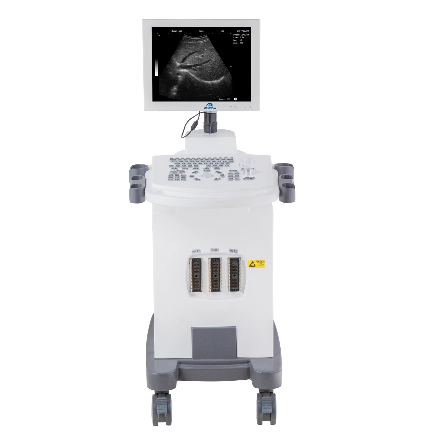 PC Platform Full-digital Trolley Ultrasound Diagnostic System RC-BW370 Black and White Electric Plastic Ce 2 Years Class II 
PC Platform Full-digital Trolley Ultrasound Diagnostic System RC-BW370 Black and White Electric Plastic Ce 2 Years Class II