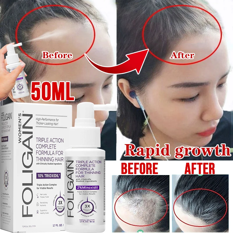 Essence hair care spray is suitable for men and women. It can quickly regenerate healthy hair and improve pores
Essence hair care spray is suitable for men and women. It can quickly regenerate healthy hair and improve pores