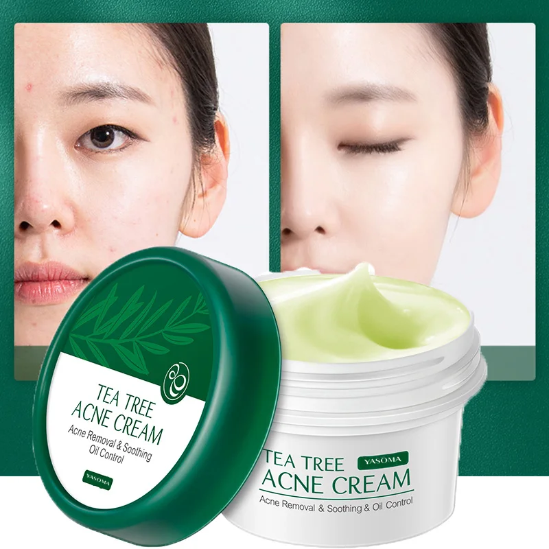 Yasoma Acne Treatment Face Cream Anti Acne Pimple Scar Remover Moisturizing Soothing Oil Control Skin Care Whitening Cream
Yasoma Acne Treatment Face Cream Anti Acne Pimple Scar Remover Moisturizing Soothing Oil Control Skin Care Whitening Cream