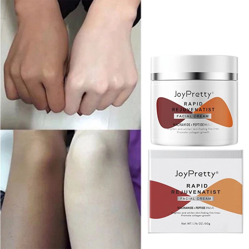 Whitening Cream Skin Care Emulsifiers Niacinamide Peptide Anti-ageing Face Wrinkl Dark Spot Remover Fade Fineline Beauty Health
Whitening Cream Skin Care Emulsifiers Niacinamide Peptide Anti-ageing Face Wrinkl Dark Spot Remover Fade Fineline Beauty Health