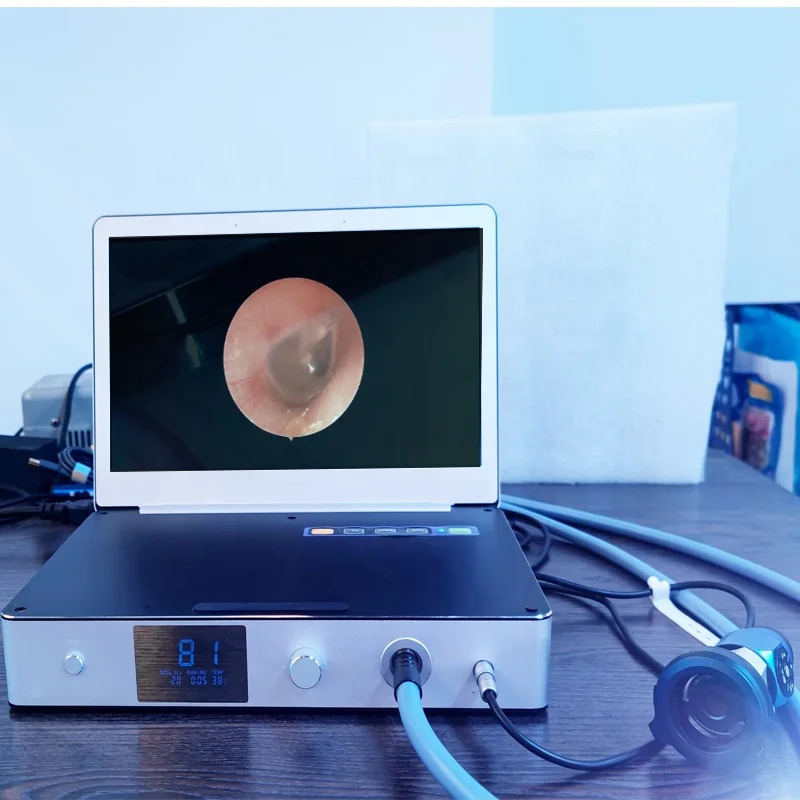 Дешевая медицинская электронная система USB со светодиодным источником светильник